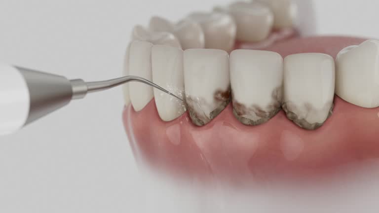 Reliable Dental Implants contractor in Basking Ridge, NJ by Smile Center Dentistry